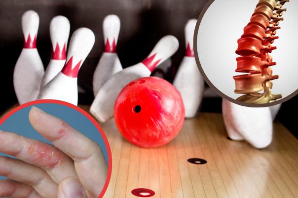 double strike for akeso