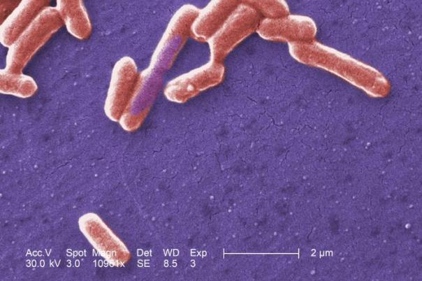 Scanning_electron_micrograph_of_an_E._coli_colony