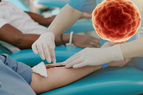 Breyanzi Gets Green Light from FDA for Marginal Zone Lymphoma